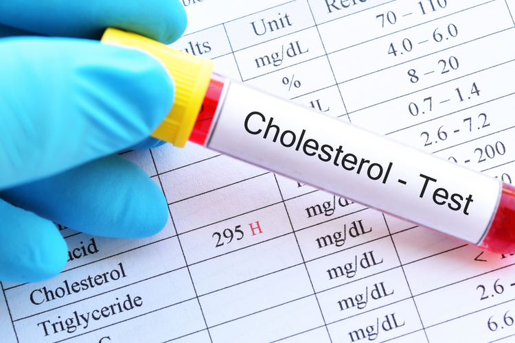 cholesterol label on test tube