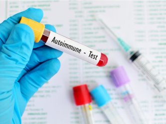 Hilft CBD bei Autoimmunkrankheiten?