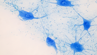 5 dôkazov o použití CBD pri ochrane nervového systému (je neuroprotektívny)
