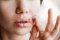 Can CBD prevent cold sores?