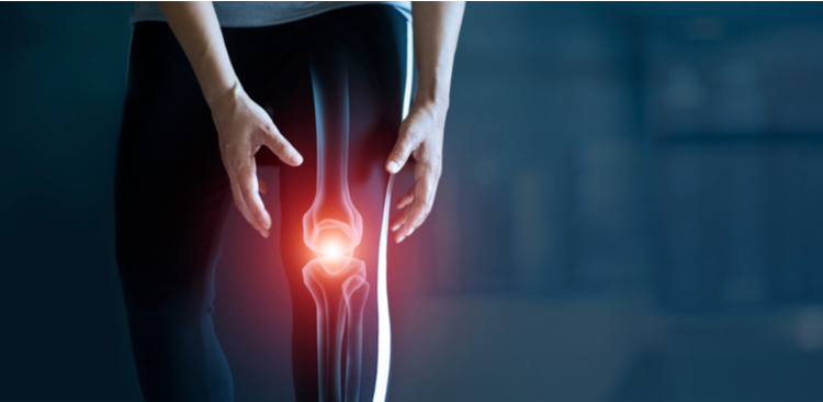 osteoarthrose