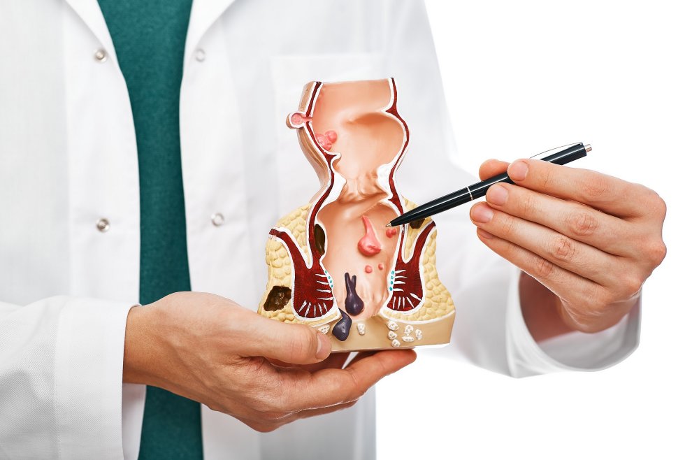 Doctor pointing to a model of the human body on a part of the body